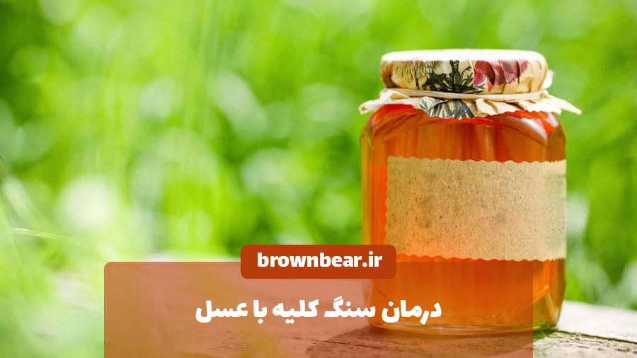 درمان سنگ کلیه با عسل